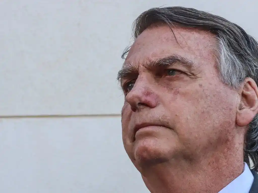 Imagem de Jair Bolsonaro tem tornozeleira eletrônica substituída em prisão domiciliar